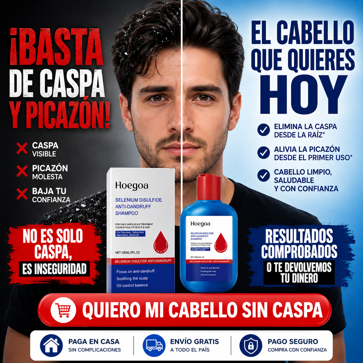 Champú Anticaspa con Selenio Hoegoa - Elimina la Grasa y limpia profundamente desde el primer uso.