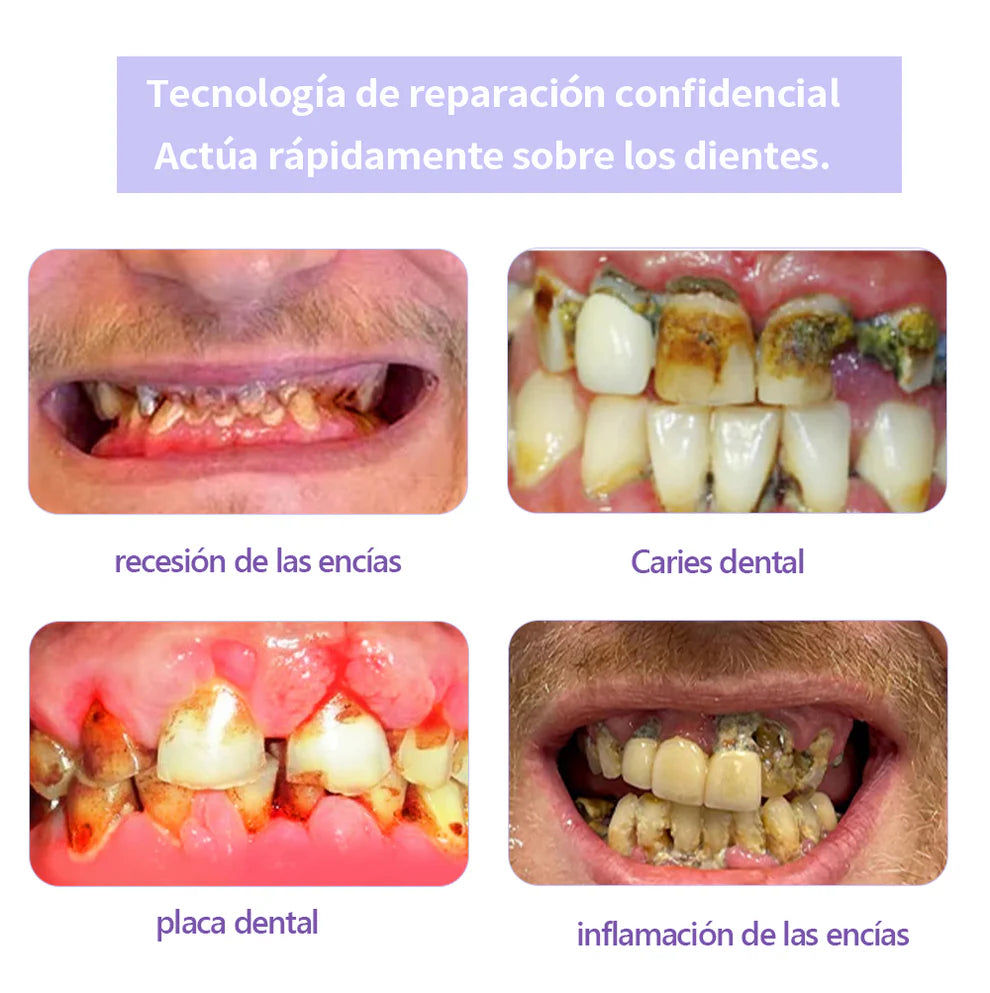 Garageline®✅Polvo Mineral para Restauración Dental