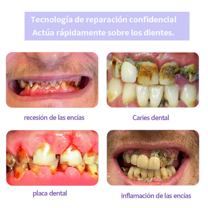 Garageline®✅Polvo Mineral para Restauración Dental