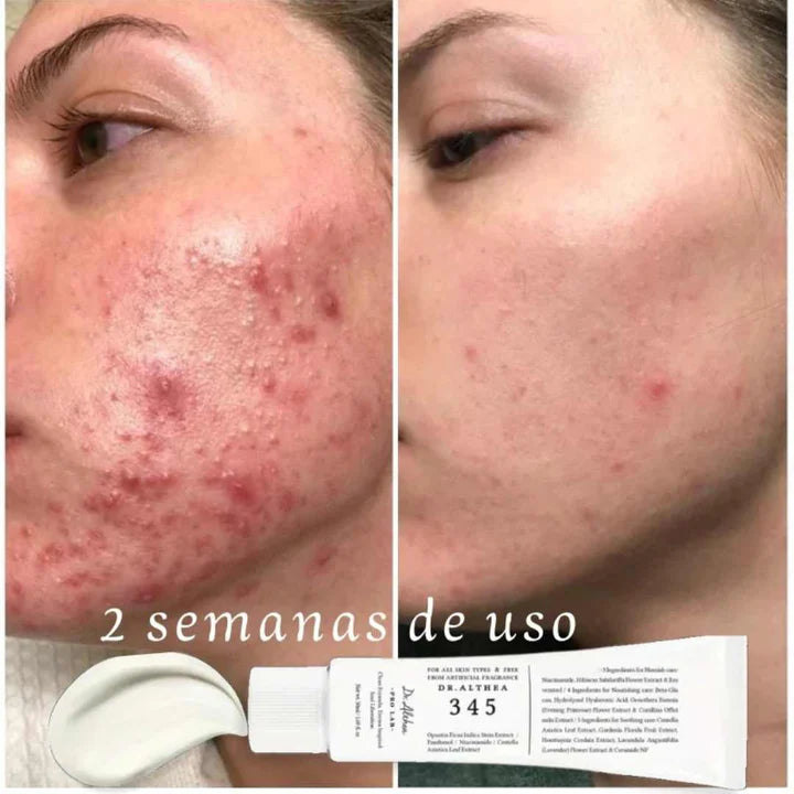 Dr. Althea 345 Relief Cream – Tu Piel Sin Manchas y Sin acne
