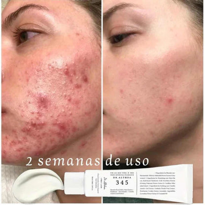 Dr. Althea 345 Relief Cream – Tu Piel Sin Manchas y Sin acne
