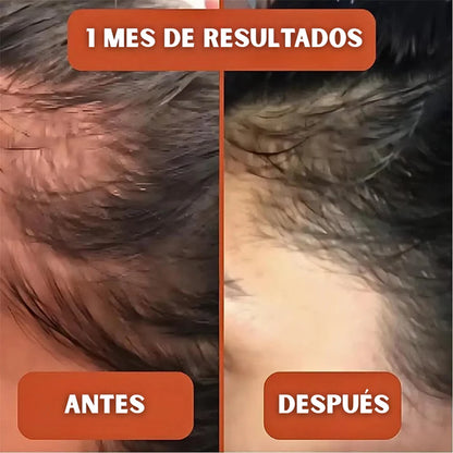 CAPSULAS DE ACEITE DE SEMILLA DE CALABAZA® Promueve el crecimiento capilar y Alivia la próstata