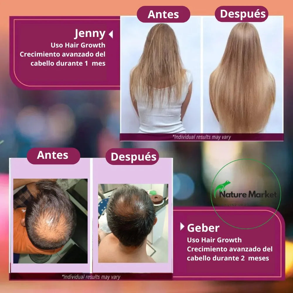 ¡Recupera tu cabello en 60 días con Hair Growth Advanced Formula!
