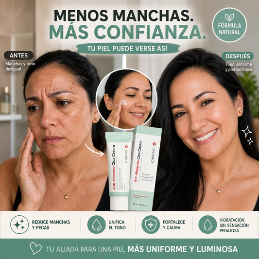 Antimelasma Cica Cream - Deshazte de las manchas persistentes desde la primera semana