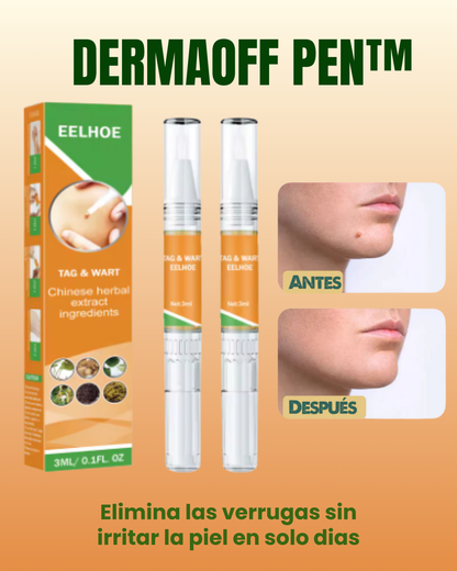 DermaOff Pen™ Lapiz de Eliminación Natural de verrugas y lunares