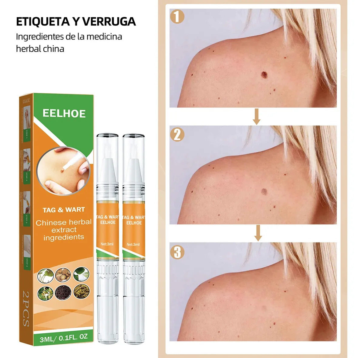 DermaOff Pen™ Lapiz de Eliminación Natural de verrugas y lunares
