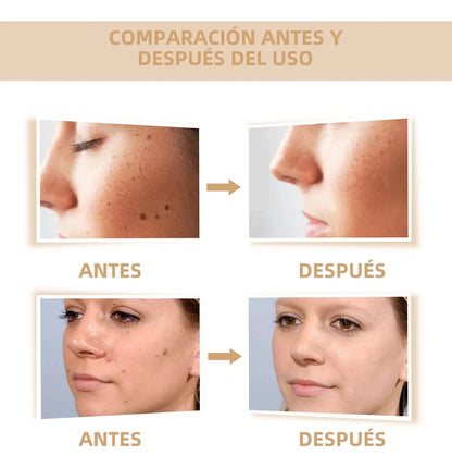 DermaOff Pen™ Lapiz de Eliminación Natural de verrugas y lunares