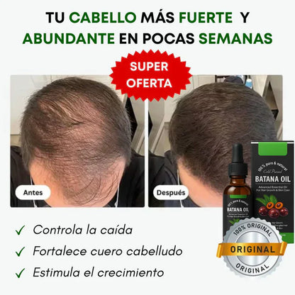Batana Oil® –  Regenerador crecimiento para el cabello