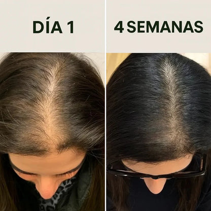 Batana Oil® –  Regenerador crecimiento para el cabello