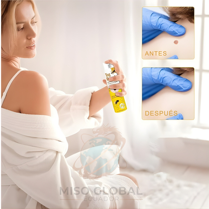 Bee Venom- Spray antiverrugas🌟